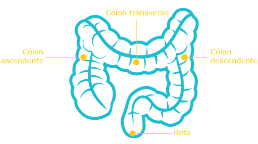 Câncer Colorretal